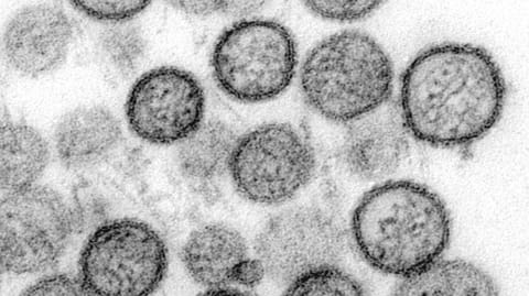 Sin Nombre virus